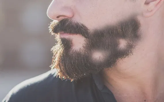 How to Fix a Patchy Beard
